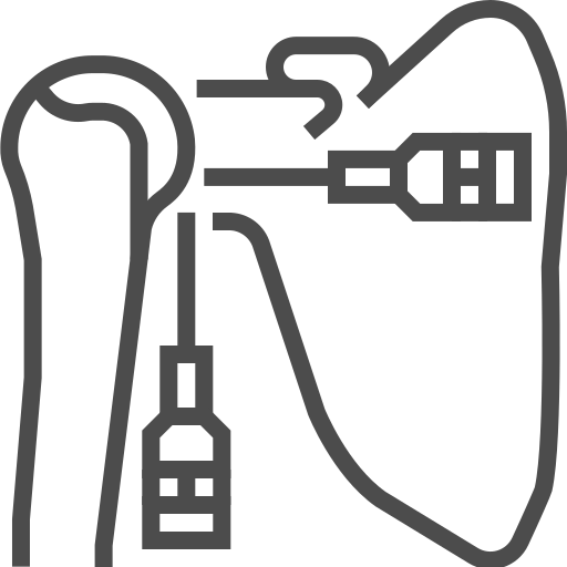 arthoscopy